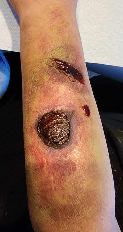 Rotted/Zombie Flesh